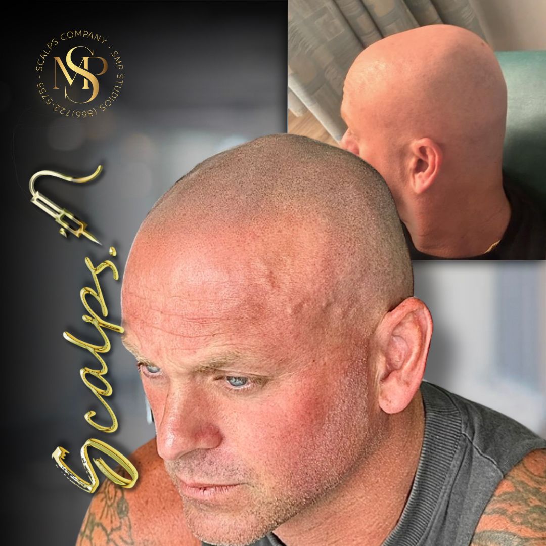 James A side view
