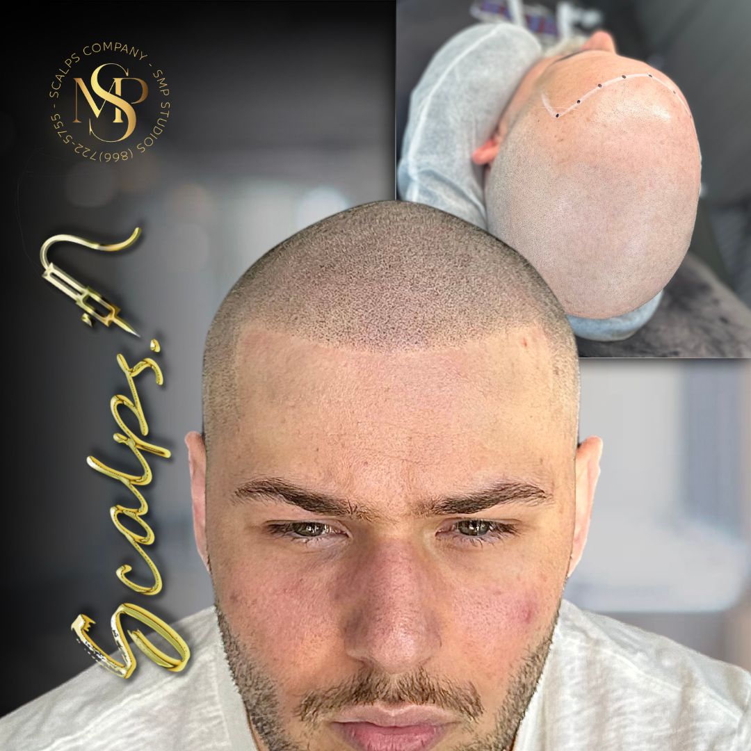 Leo T BEFORE AFTER