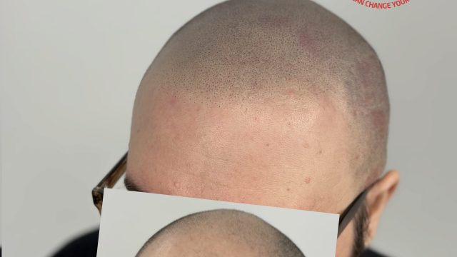 bald-head-to-barber-fresh-smp