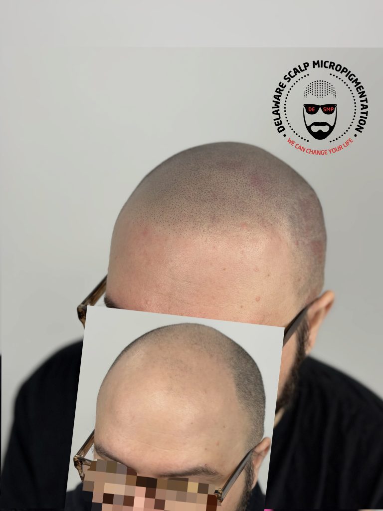 Delaware Scalp Micropigmentation studio photograph 5