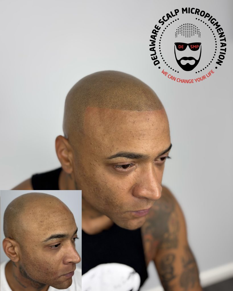 Delaware Scalp Micropigmentation studio photograph 4