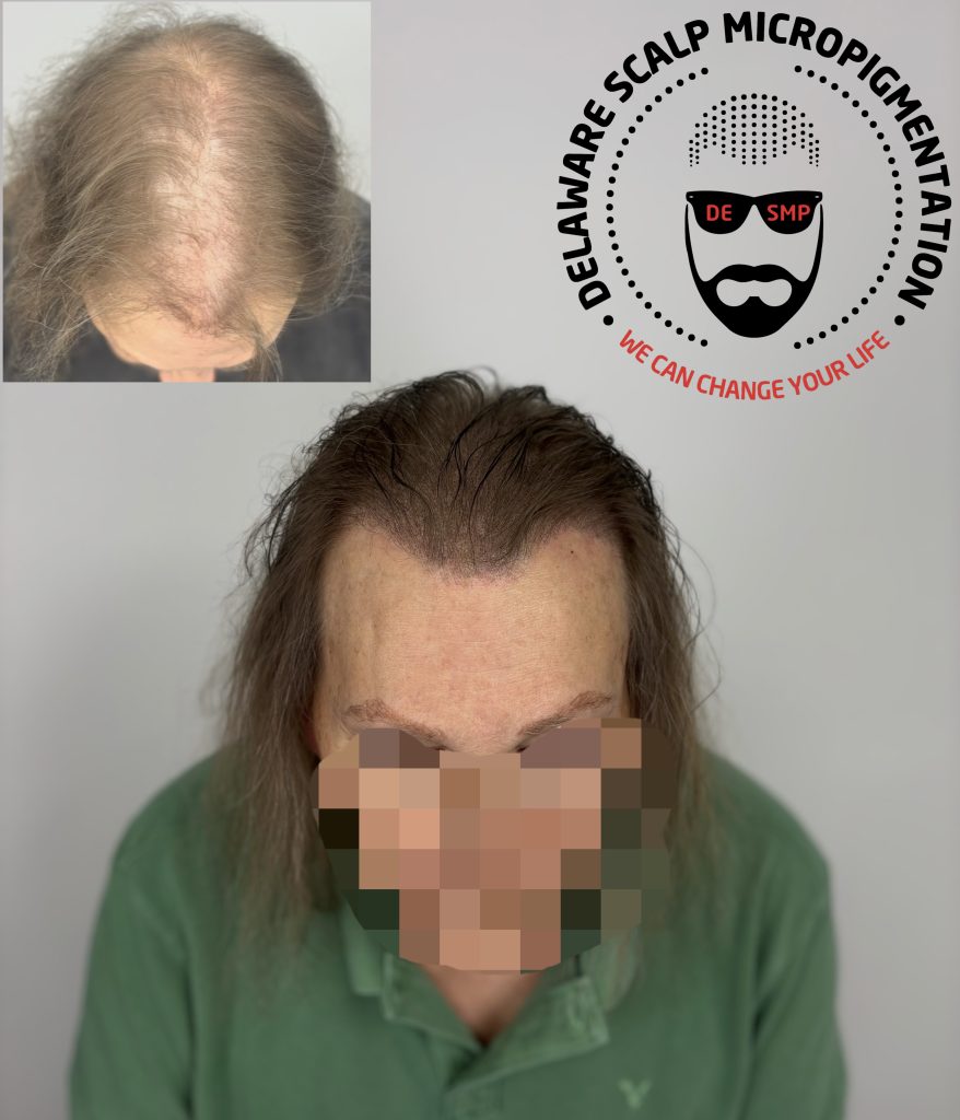 Delaware Scalp Micropigmentation studio photograph 6