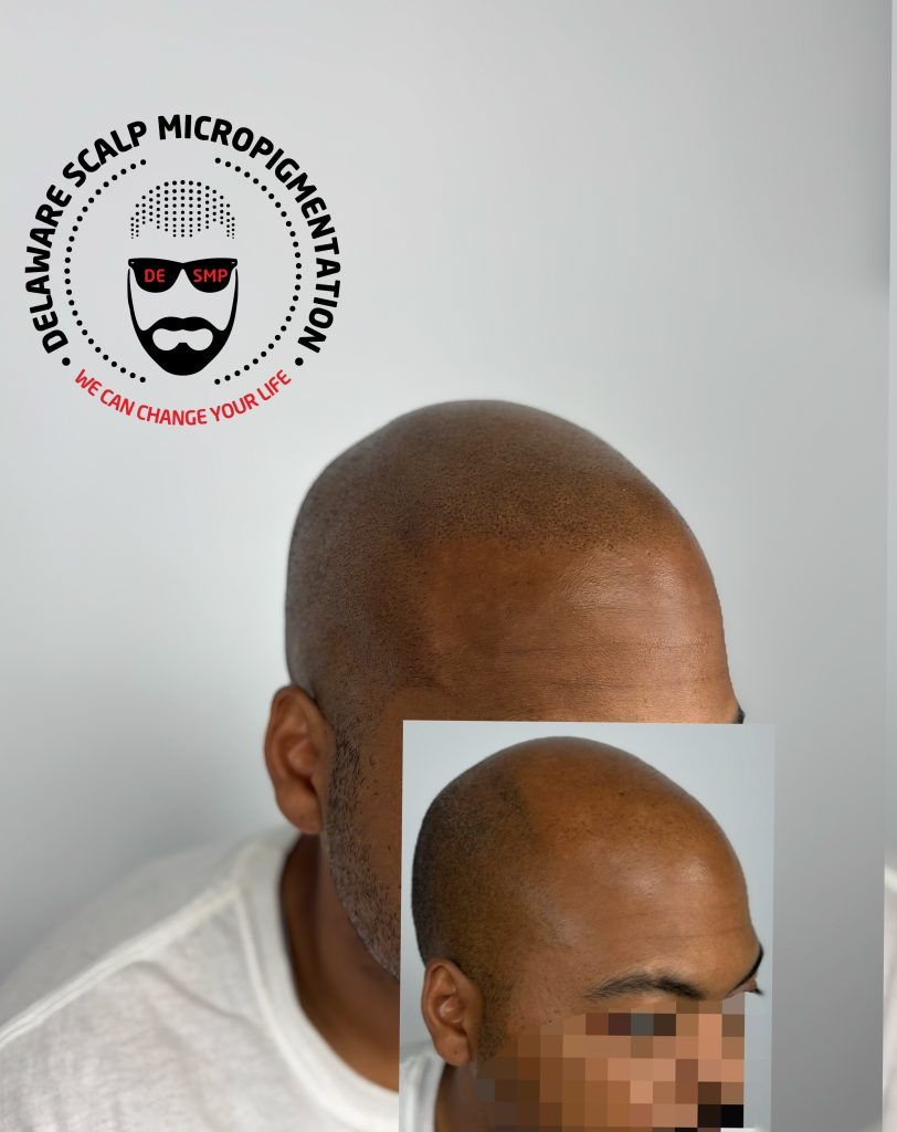 Delaware Scalp Micropigmentation studio photograph 3