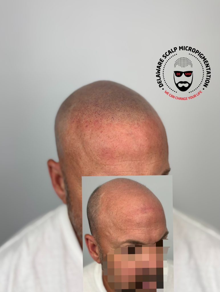 Delaware Scalp Micropigmentation studio photograph 2
